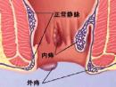 江蘇華夏吻合器的種類及分類